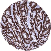 Anti-SATB2 antibody [MSVA-702R] HistoMAX&trade; used in IHC (Paraffin sections) (IHC-P). GTX04414