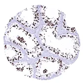 Anti-Topoisomerase II alpha antibody [MSVA-802R] HistoMAX&trade; used in IHC (Paraffin sections) (IHC-P). GTX04422