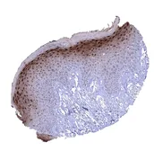 Anti-Cystatin A antibody [MSVA-461M] HistoMAX&trade; used in IHC (Paraffin sections) (IHC-P). GTX04453