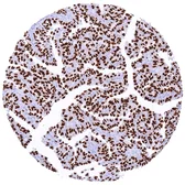 Anti-NKX2.1 antibody [MSVA-312R] HistoMAX&trade; used in IHC (Paraffin sections) (IHC-P). GTX04489