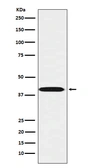 Anti-LHX3 antibody [24L36] used in Western Blot (WB). GTX04502