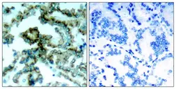 Anti-PKC beta 1 (phospho Thr642) antibody used in IHC (Paraffin sections) (IHC-P). GTX04595