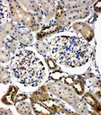 Anti-WISP1 antibody used in IHC (Paraffin sections) (IHC-P). GTX04633