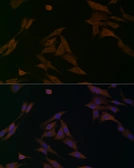 Anti-BCAT1 antibody used in Immunocytochemistry/ Immunofluorescence (ICC/IF). GTX04696