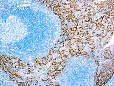 Anti-Cytokeratin 5/14 antibody [XM26 + LL002] used in IHC (Paraffin sections) (IHC-P). GTX04713