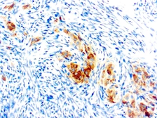 Anti-Inhibin alpha antibody [R1] used in IHC (Paraffin sections) (IHC-P). GTX04714