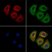 Anti-Calcitonin Receptor antibody used in Immunocytochemistry/ Immunofluorescence (ICC/IF). GTX04724