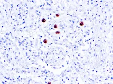 Anti-Cytomegalovirus antibody [DDG9 + CCH2] used in IHC (Paraffin sections) (IHC-P). GTX04739