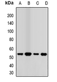 Anti-Transcobalamin 2 antibody used in Western Blot (WB). GTX04826