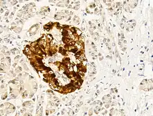 Anti-MMP13 antibody used in IHC (Paraffin sections) (IHC-P). GTX04845