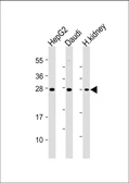 Anti-TIM-3 antibody [1827CT151.74.68] used in Western Blot (WB). GTX04870