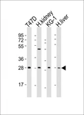 Anti-TIM-3 antibody used in Western Blot (WB). GTX04871