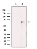 Anti-TRP1 antibody used in Western Blot (WB). GTX04910