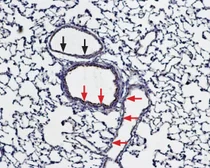 Anti-Bestrophin 1 antibody used in IHC (Paraffin sections) (IHC-P). GTX04928