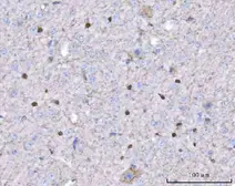 Anti-Twist1/2 antibody used in IHC (Paraffin sections) (IHC-P). GTX04942