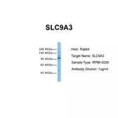 Anti-NHE3 antibody used in Western Blot (WB). GTX04975