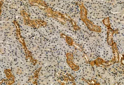 Anti-IRE1 alpha (phospho Ser724) antibody used in IHC (Paraffin sections) (IHC-P). GTX05026