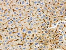 Anti-TREM1 antibody used in IHC (Paraffin sections) (IHC-P). GTX05054