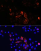 Anti-MT-ND2 antibody used in Immunocytochemistry/ Immunofluorescence (ICC/IF). GTX05067