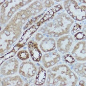 Anti-MTCO2 antibody used in IHC (Paraffin sections) (IHC-P). GTX05069