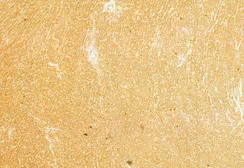Anti-FIS1 antibody used in IHC (Paraffin sections) (IHC-P). GTX05149