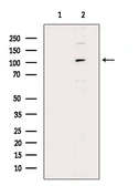 Anti-OPA1 antibody used in Western Blot (WB). GTX05152