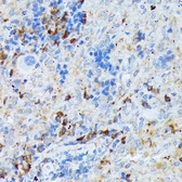 Anti-DC-SIGN antibody [ARC1679] used in IHC (Paraffin sections) (IHC-P). GTX05202