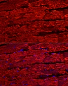 Anti-BNP / proBNP antibody used in IHC (Paraffin sections) (IHC-P). GTX05212
