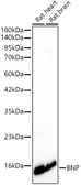 Anti-BNP antibody [ARC62057] used in Western Blot (WB). GTX05213