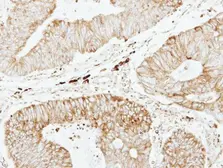 Anti-GSTP1 antibody [N1N2], N-term used in IHC (Paraffin sections) (IHC-P). GTX100299