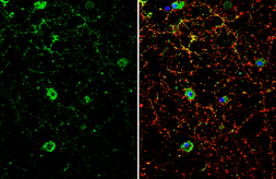 Anti-Dopamine Receptor D1 antibody [C2C3], C-term used in Immunocytochemistry/ Immunofluorescence (ICC/IF). GTX100354