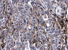 Anti-Urokinase antibody used in IHC (Paraffin sections) (IHC-P). GTX100465