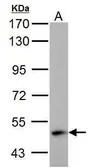Anti-ABAT antibody used in Western Blot (WB). GTX100479