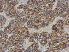 Anti-ACADL antibody [N1N2], N-term used in IHC (Paraffin sections) (IHC-P). GTX100486
