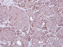 Anti-XIAP antibody [C1C3] used in IHC (Paraffin sections) (IHC-P). GTX100496