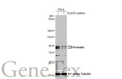 Anti-Periostin antibody used in Western Blot (WB). GTX100602 Anti-Periostin antibody used in Western Blot (WB). GTX100602