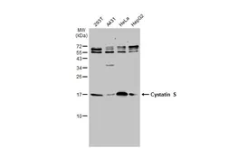 Anti-Cystatin S antibody [N1N3] used in Western Blot (WB). GTX100690