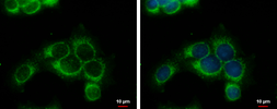 Anti-RRM1 antibody used in Immunocytochemistry/ Immunofluorescence (ICC/IF). GTX100758