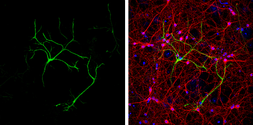 Anti-GFAP antibody used in Immunocytochemistry/ Immunofluorescence (ICC/IF). GTX100850