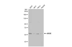 Anti-ARSE antibody [C2C3], C-term used in Western Blot (WB). GTX101335