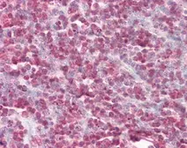 Anti-Cystatin B antibody used in IHC (Paraffin sections) (IHC-P). GTX101458