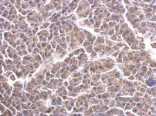 Anti-CYC1 antibody used in IHC (Paraffin sections) (IHC-P). GTX101717