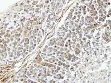 Anti-TUFM antibody [N3C3] used in IHC (Paraffin sections) (IHC-P). GTX101764