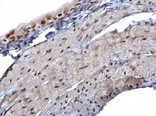 Anti-hnRNP K antibody used in IHC (Paraffin sections) (IHC-P). GTX101786