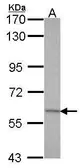 Anti-GAD67 antibody [N3C3] used in Western Blot (WB). GTX101880