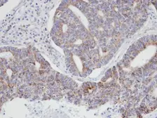 Anti-p21-ARC antibody [N1C3] used in IHC (Paraffin sections) (IHC-P). GTX101982