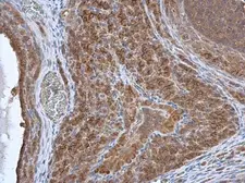 Anti-HAX1 antibody used in IHC (Paraffin sections) (IHC-P). GTX101992