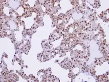 Anti-SFRS17A antibody [C2C3], C-term used in IHC (Paraffin sections) (IHC-P). GTX102065
