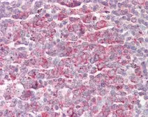 Anti-MRPL23 antibody [N1C3] used in IHC (Paraffin sections) (IHC-P). GTX102094