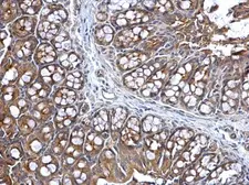 Anti-Lysyl-tRNA synthetase antibody used in IHC (Paraffin sections) (IHC-P). GTX102113